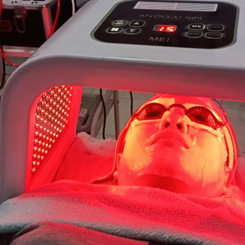 Facial whitening