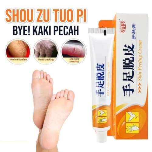 Krim Salep Tumit Ampuh Untuk Kaki Tangan Tumit Kapalan Kering Pecah-pecah