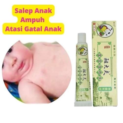 ZUDAIFU ANAK 15gr Original 100% - Salep Zu Dai Fu Khusus Anak Bayi Balita - Krim Cream Obat Gatal
