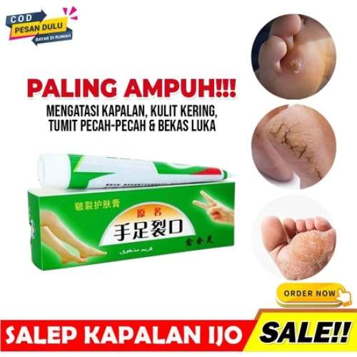 AMPUHH Salep Krim Ijo Obat Kaki Pecah Pecah Kering Kapalan Jamur Tumit Rangen Rayapan Tumitku