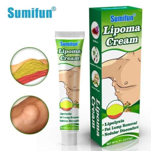 [Barang asli] Lipoma Cream Obat Benjolan di Leher Benjolan Di Tangan Benjolan Di Ketiak Dan Punggung